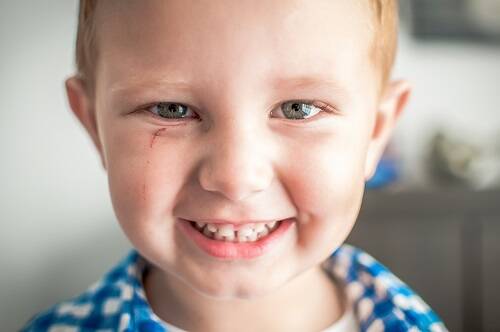 Rola witamin w utrzymaniu zdrowia jamy ustnej u dzieci